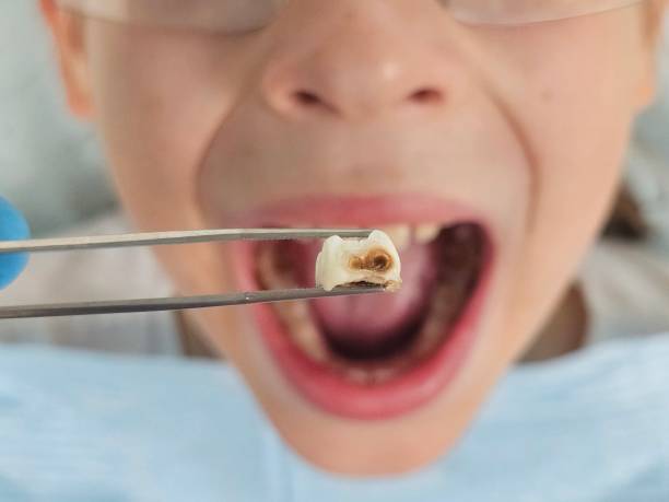 Best Emergency Dentist for Special Needs Patients in Herald Harbor, MD